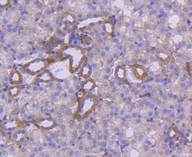 Anti-NFKBIA Antibody (1J77)