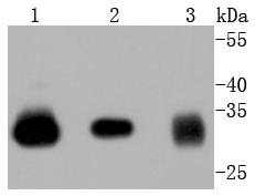 Anti-NFKBIA Antibody (1J77)