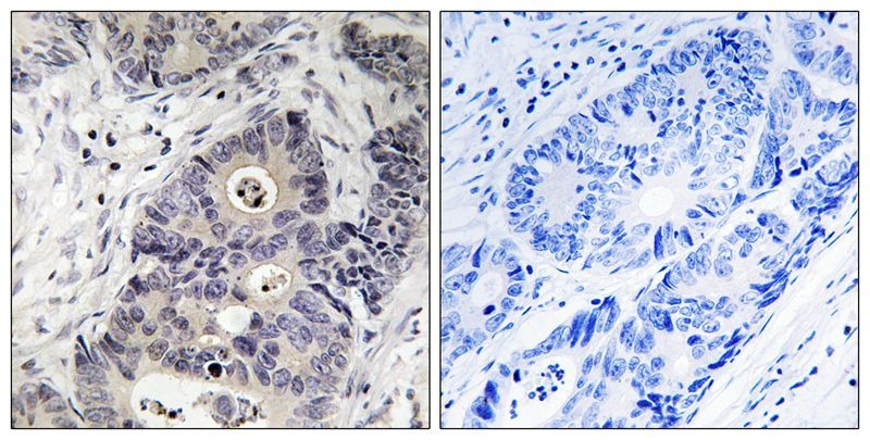 Anti-Phospho-iNOS (Tyr151) Polyclonal Antibody
