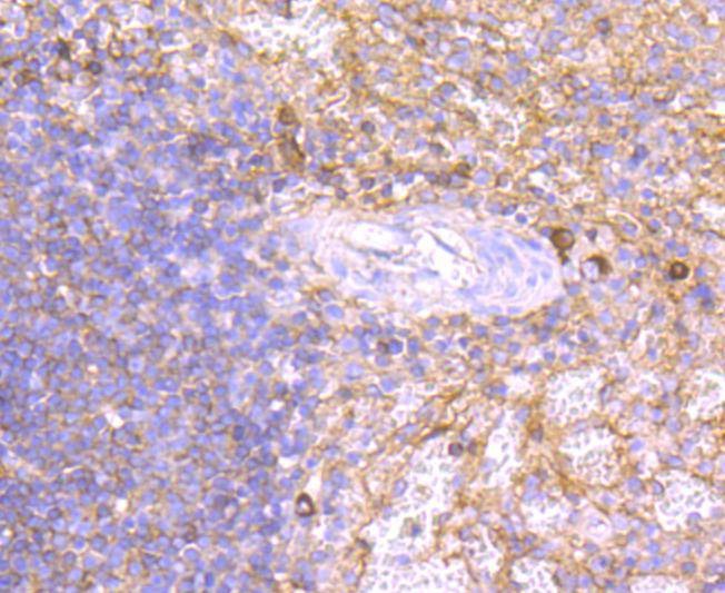 Anti-Human IgM Antibody (7U224)