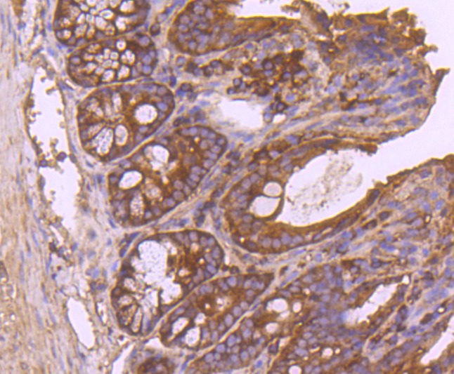 Anti-IDE Antibody (5U690)