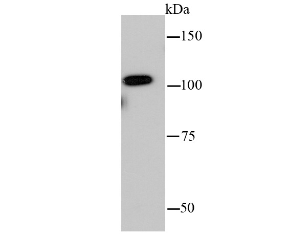 Anti-IDE Antibody (5U690)