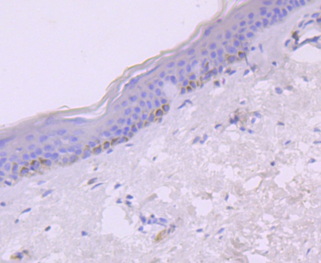 Anti-CXCL10 Antibody (9G778)