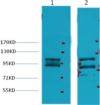 Anti-IDE Antibody (7S578)