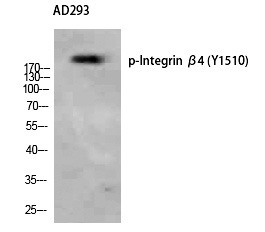 Anti-Phospho-ITGB4 (Tyr1510) Polyclonal Antibody 2
