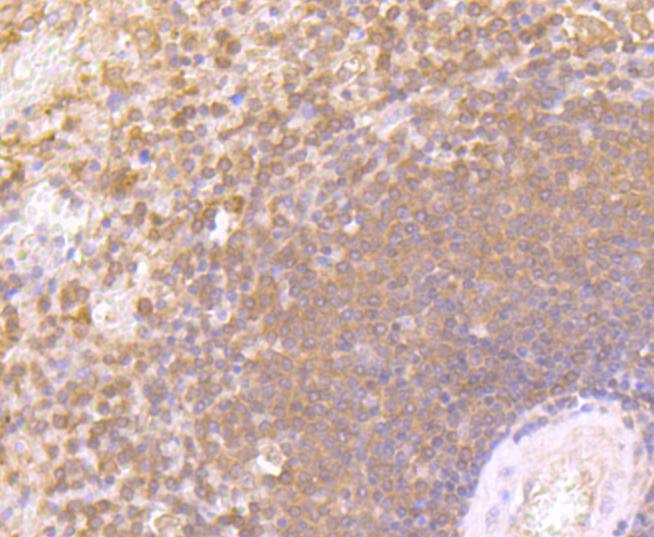Anti-IFN gamma Antibody (1T875)