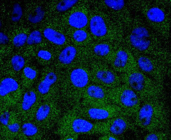 Anti-HSPA14 Antibody (8Q329)