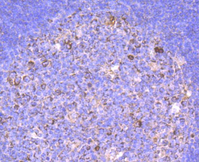 Anti-Human IgM Antibody (7U224)