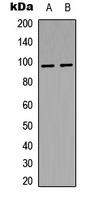 Anti-Phospho-Insulin Receptor (Tyr1361) Polyclonal Antibody 2