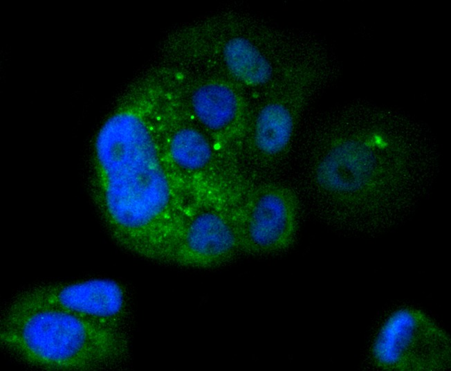 Anti-IkappaB- beta Antibody (5Y651)