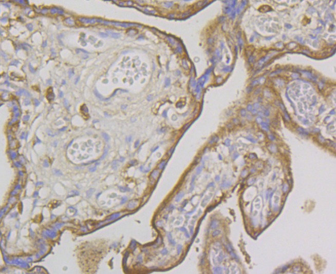 Anti-IQGAP1 Antibody (5T212)
