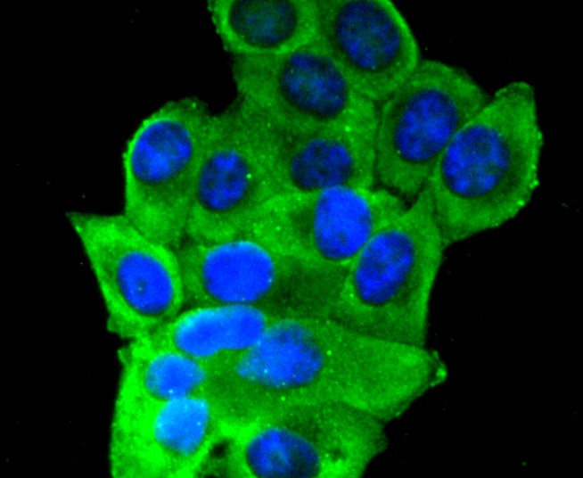 Anti-Insulin Receptor Antibody (5X84)