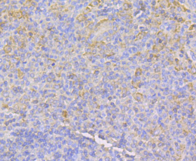 Anti-IQGAP1 Antibody (5T212)