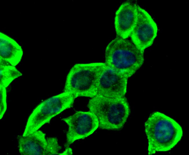 Anti-Insulin Receptor Antibody (5X84)