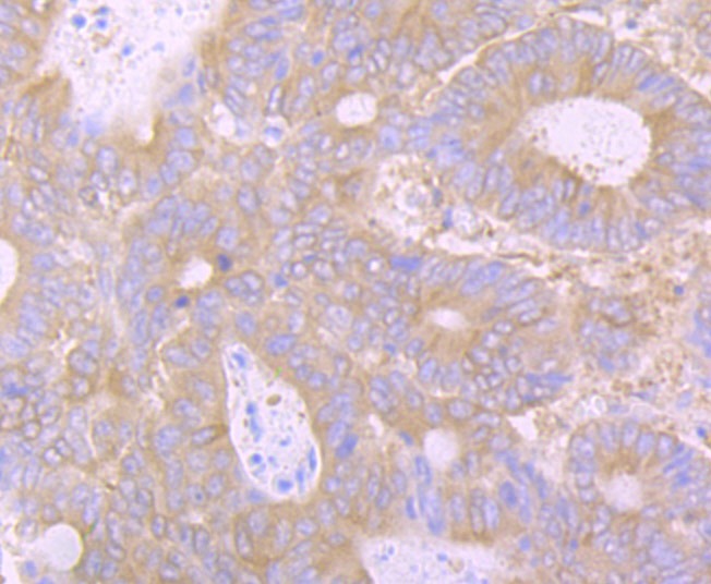 Anti-HTT Antibody (6D662)