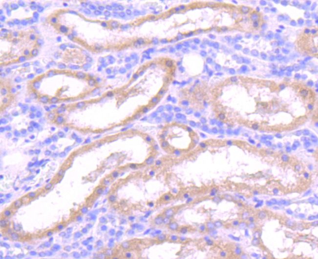 Anti-IDE Antibody (5U690)