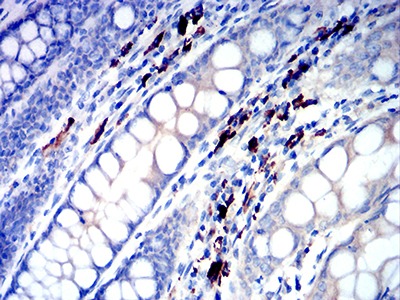 Anti-Ig lambda constant 2 Antibody (9U628)