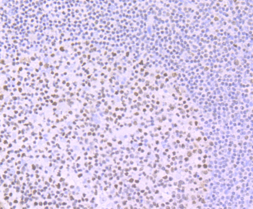 Anti-IKZF1 Antibody (8M494)