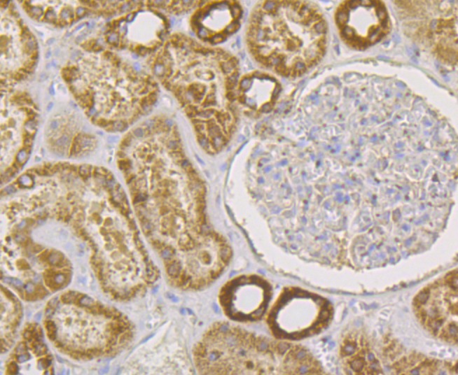 Anti-hUPF1 Antibody (4P615)