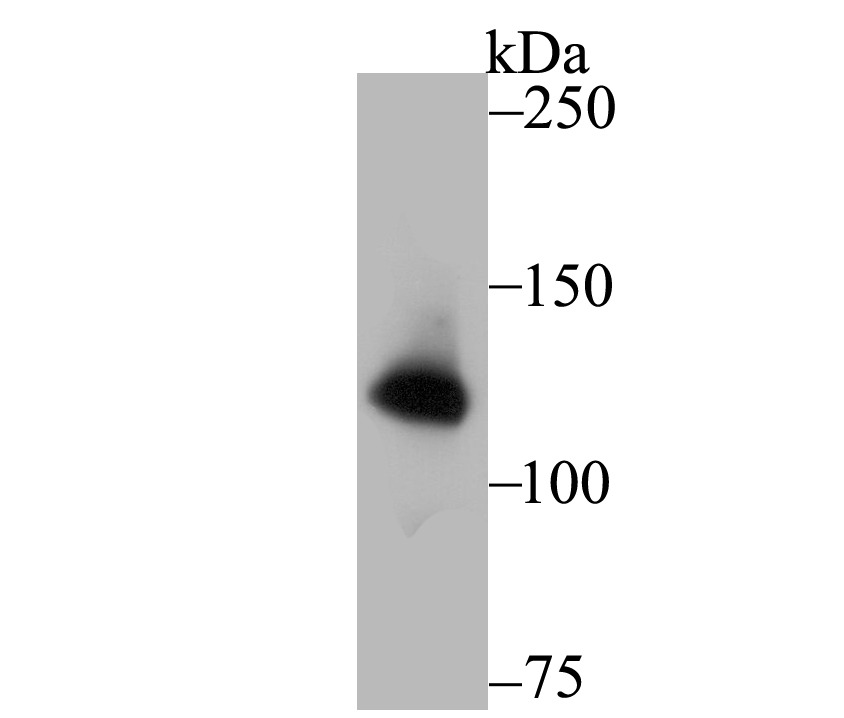 Anti-hUPF1 Antibody (4P615)