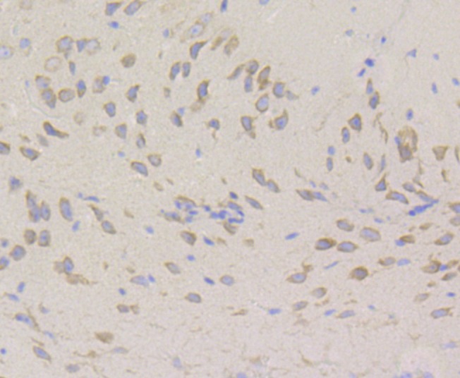 Anti-hUPF1 Antibody (4P615)