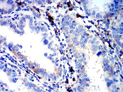Anti-Ig lambda constant 2 Antibody (9U628)