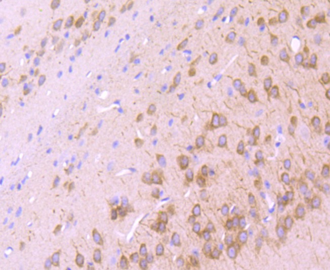 Anti-IP3 Receptor Antibody (9Q478)