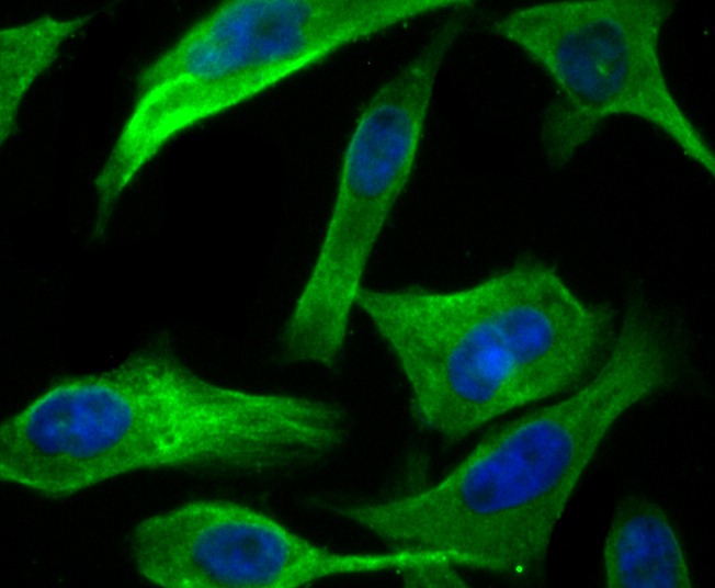 Anti-hUPF1 Antibody (4P615)