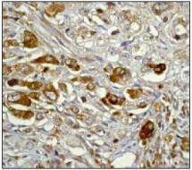 Anti-NFKBIA Antibody (9N642)