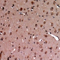 Anti-Phospho-TYRO3/MERTK (Tyr749, 681) Polyclonal Antibody