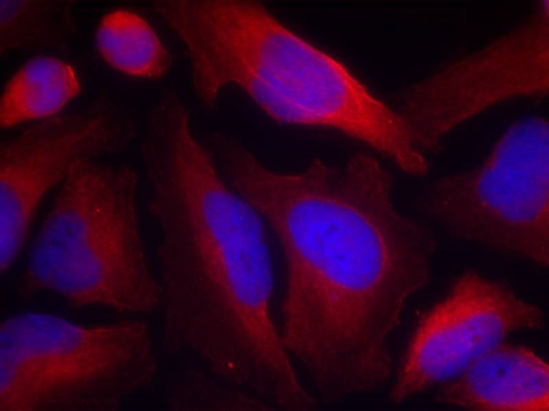 Anti-Phospho-Tyrosine Hydroxylase (Ser19) Polyclonal Antibody