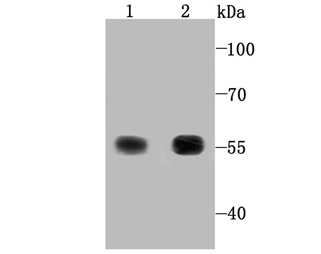 Anti-TRXR1/TXNRD1 Antibody (8M522)