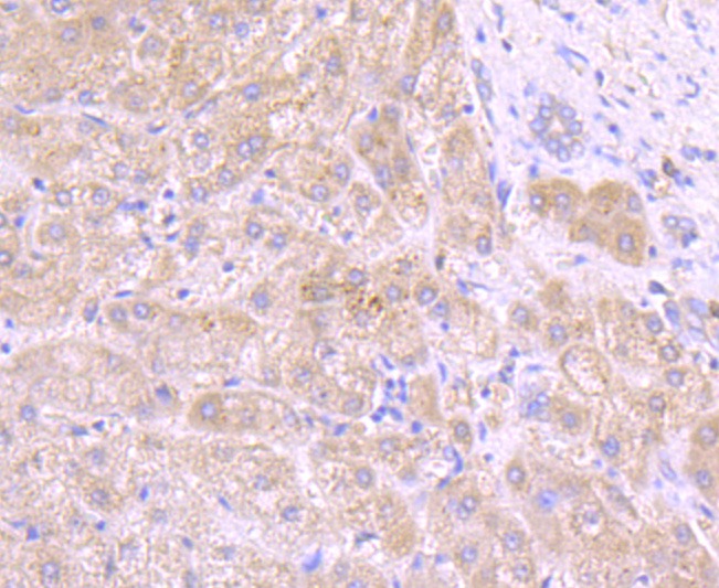 Anti-Tyrosinase/TYR Antibody (5B146)