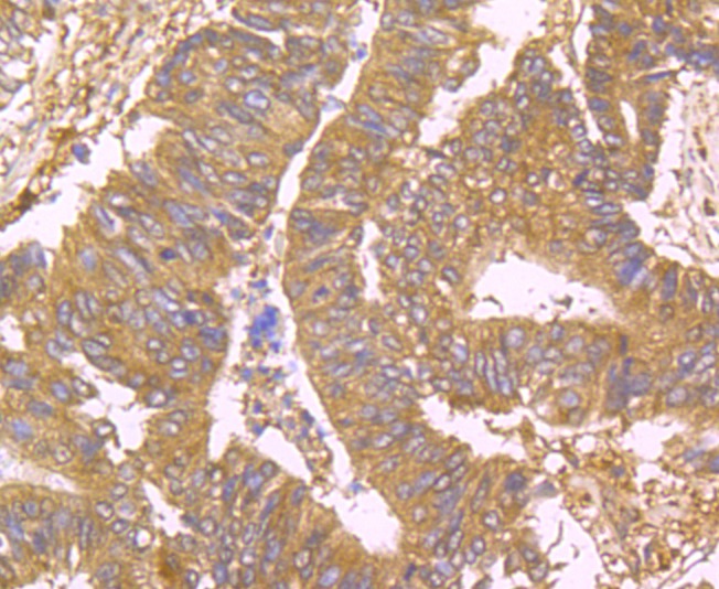 Anti-USP10 Antibody (1T260)