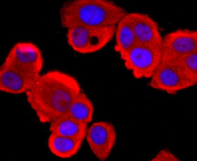 Anti-Tyrosinase/TYR Antibody (5B146)