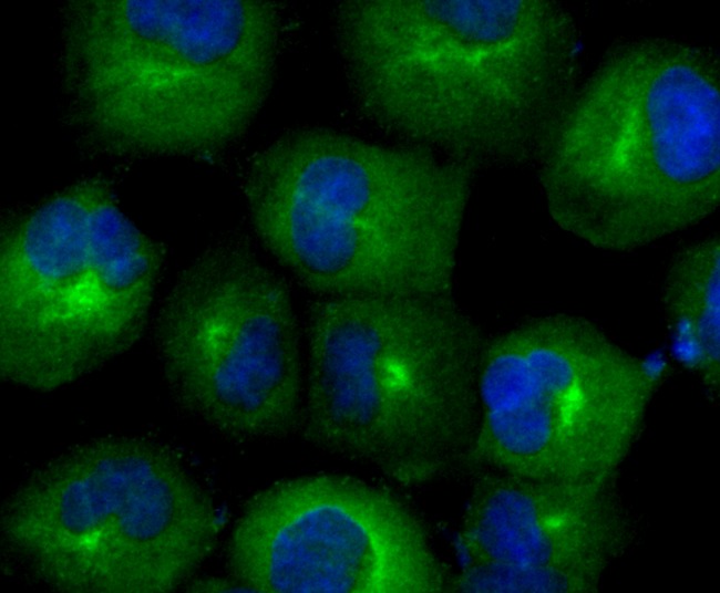 Anti-TRXR1/TXNRD1 Antibody (8M522)