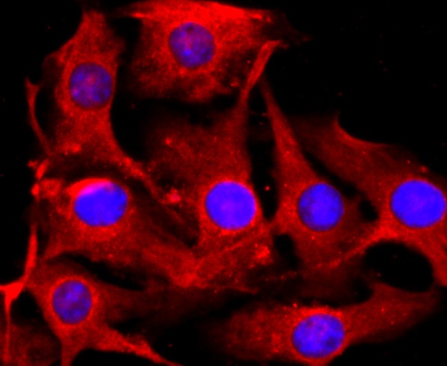 Anti-Tyrosinase/TYR Antibody (5B146)