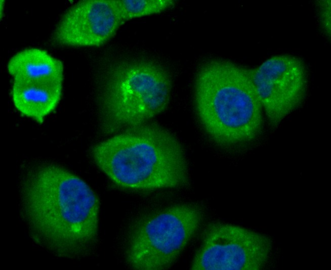 Anti-USP14 Antibody (2A615)