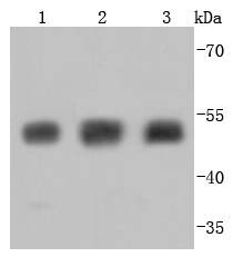 Anti-TUBB3 Antibody (5D159)