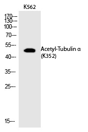Anti-Acetyl-Tubulin α (Lys352) Polyclonal Antibody