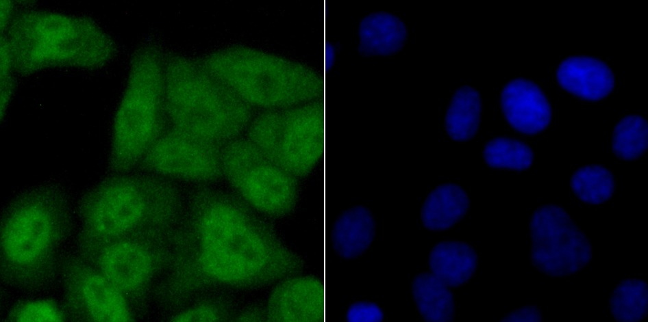 Anti-USP11 Antibody (1W222)