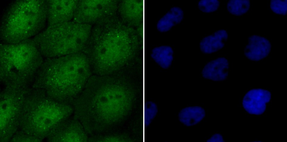 Anti-USP13 Antibody (7A655)