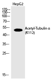 Anti-Acetyl-Tubulin α (Lys112) Polyclonal Antibody