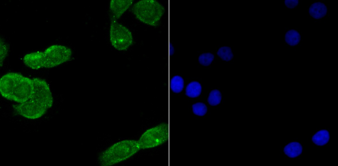 Anti-USP22 Antibody (1F346)