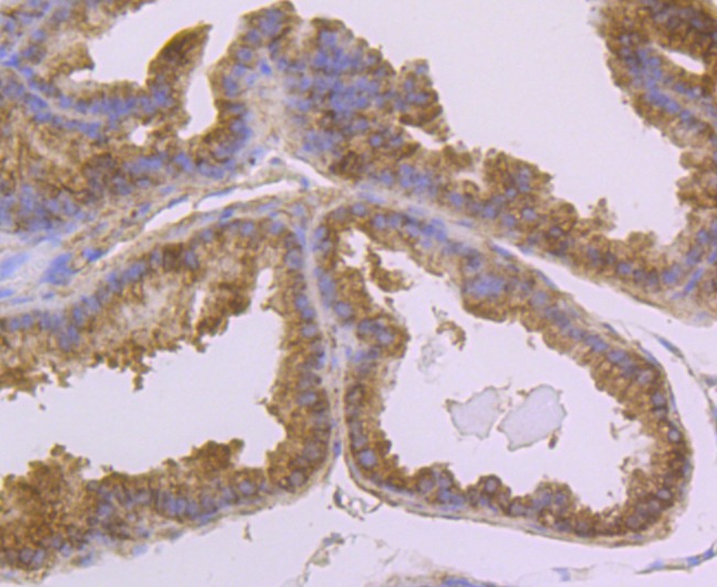 Anti-USP14 Antibody (2A615)