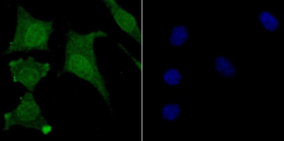 Anti-USP11 Antibody (1W222)