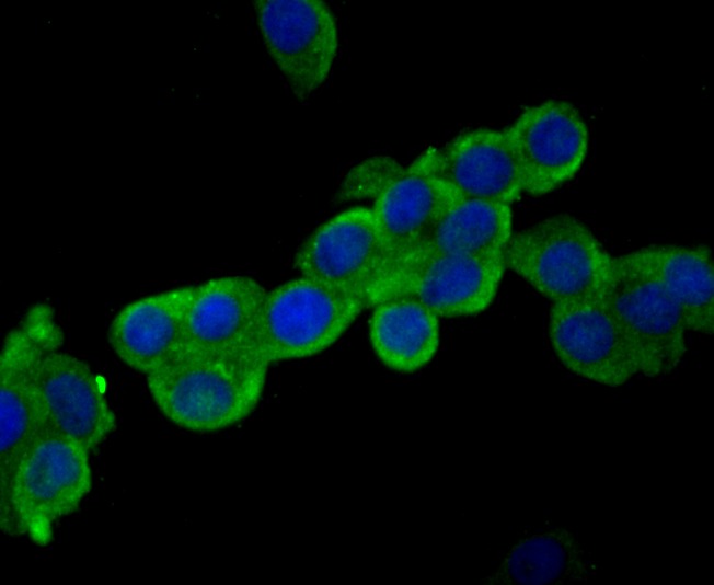 Anti-USP14 Antibody (2A615)