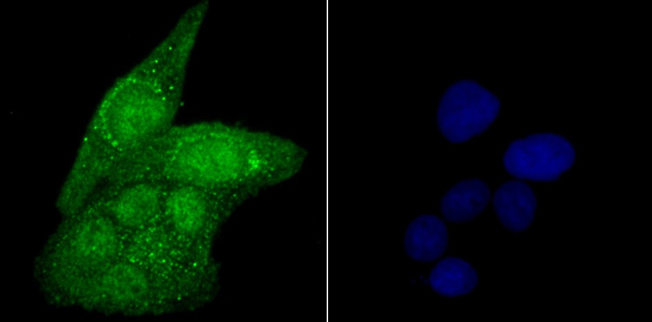 Anti-USP22 Antibody (1F346)
