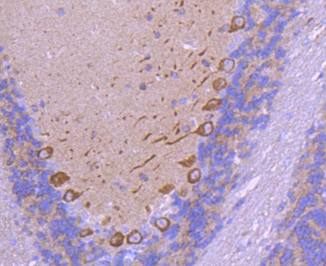 Anti-VEGFA Antibody (8D813)