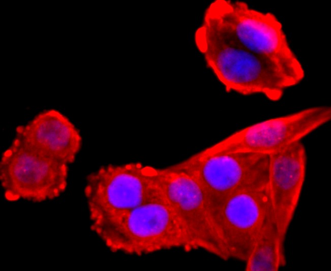 Anti-VCP Antibody (3I403)